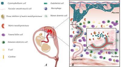 Insights into the immunomodulatory regulation of matrix metalloproteinase at the maternal-fetal interface during early pregnancy and pregnancy-related diseases